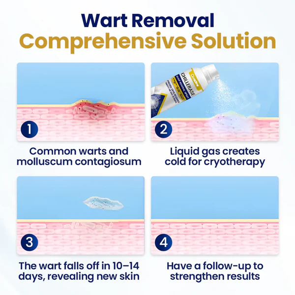 Coredew® ChillErase Bump Renewal Spray